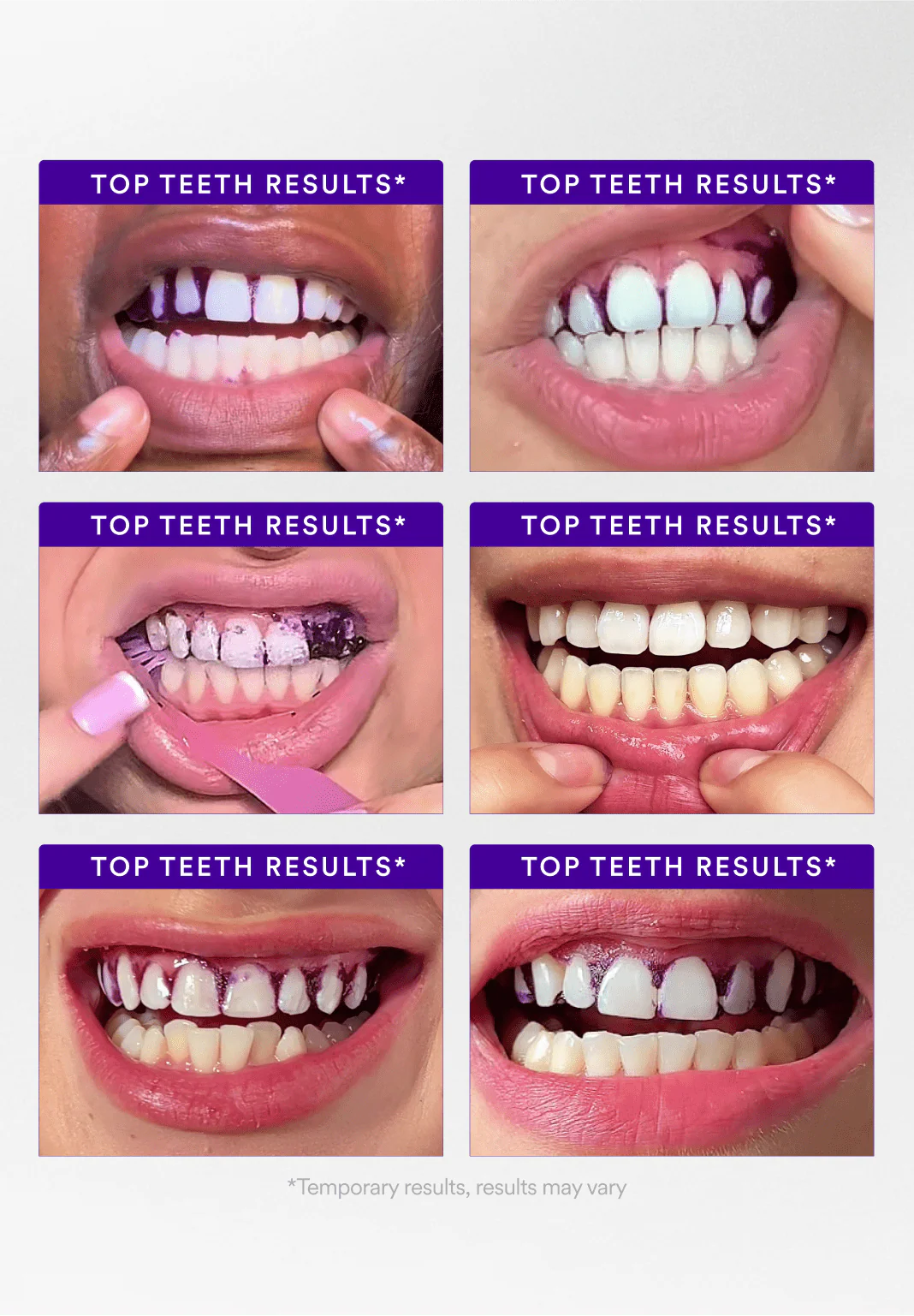 Whitening Strips